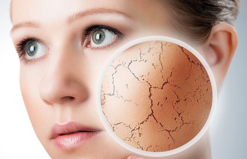 انواع بیماری های پوستی و عارضه های آن